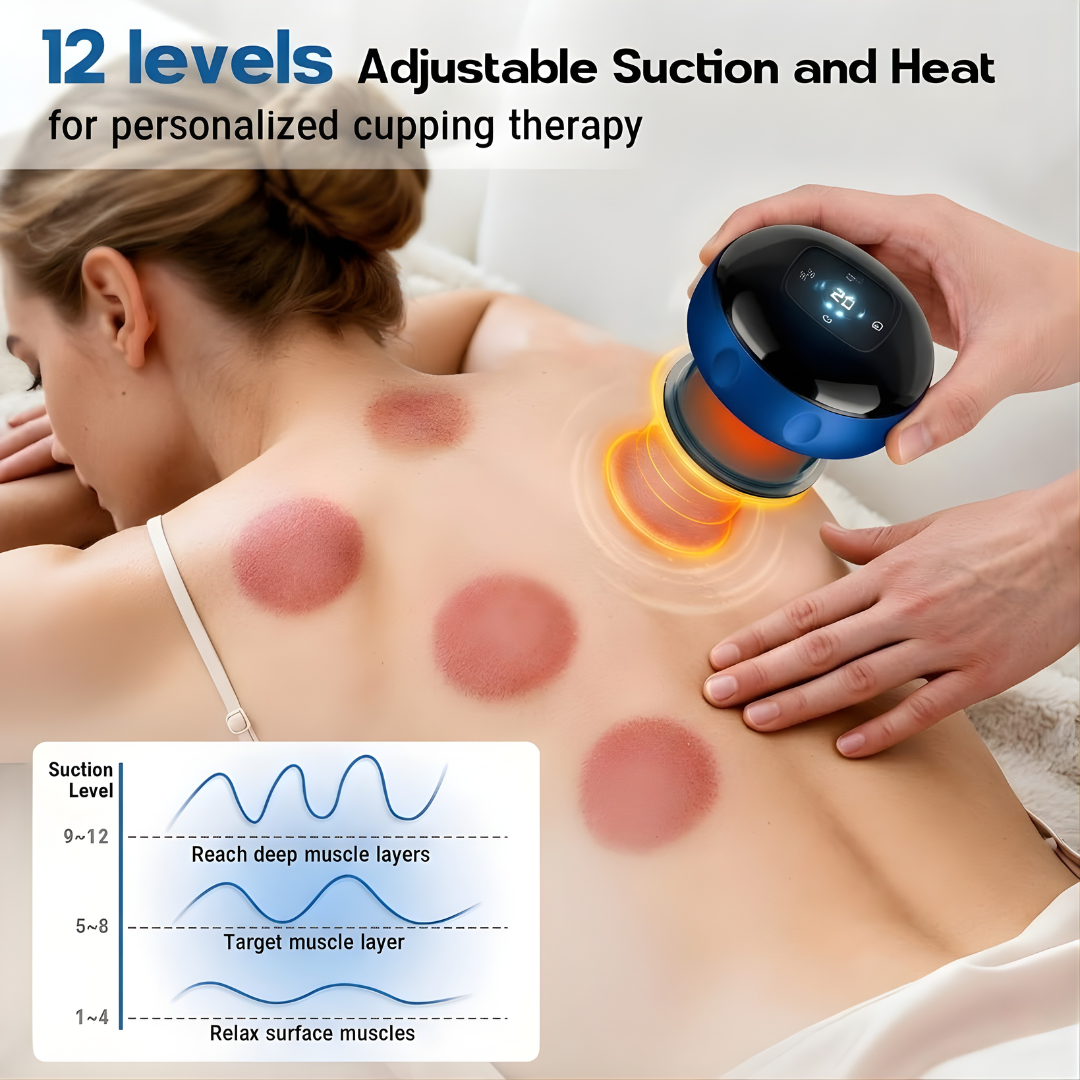 VILESO™ - Smart Cupping