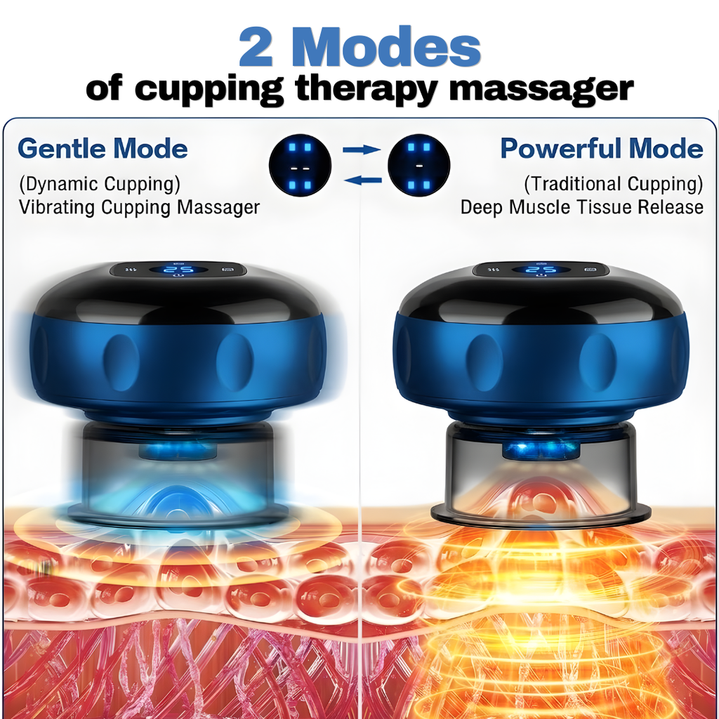 VILESO™ - Smart Cupping