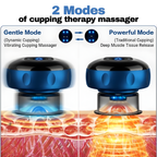 VILESO™ - Smart Cupping