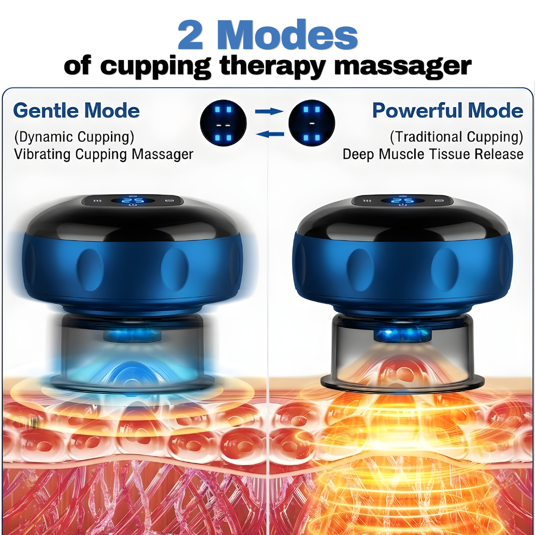 VILESO™ - Smart Cupping